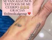 El costoso tratamiento que sigue Mica Tinelli para quitarse sus tatuajes 