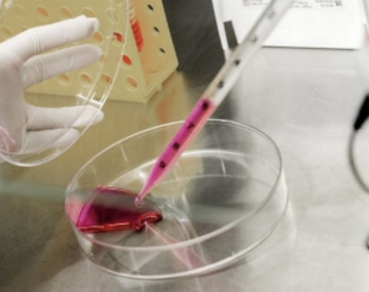 Avanza el desarrollo de un test para detectar cáncer de mama y de próstata en forma precoz