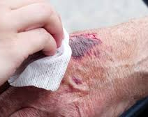 Por querer esquivar un pozo un anciano se partió la cabeza 