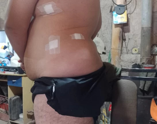 Volvía en bici de su trabajo y lo apuñalaron siete veces en una zona oscura