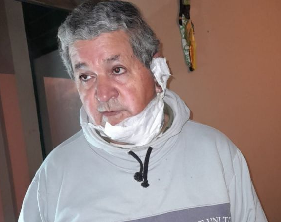 Su ex intentó quemarlo, ella quedó libre y ahora él la acusó de psicópata