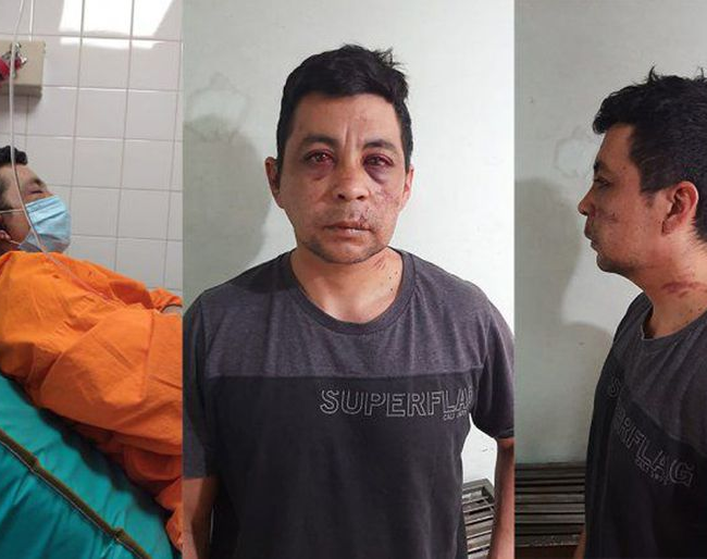 Un enfermero linchado por sus vecinos en 2020, murió de un paro cardíaco