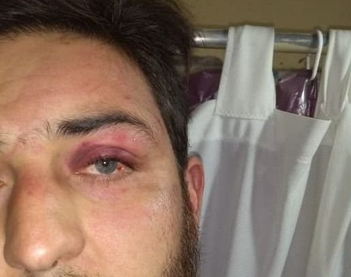 Golpiza en Pocito: echaron a los seis policías