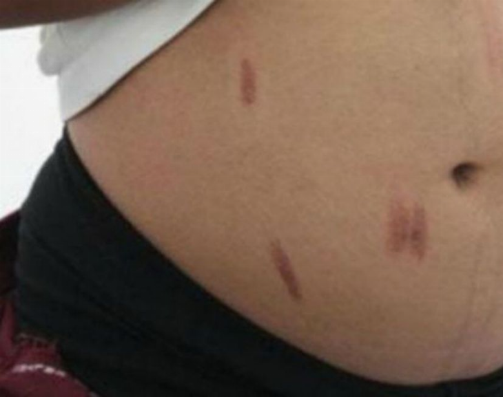Dos hermanas embarazadas resultaron heridas luego de agredirse con cuchillos 