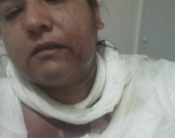 De locos: discutió con su nuera y le tiró agua hirviendo 