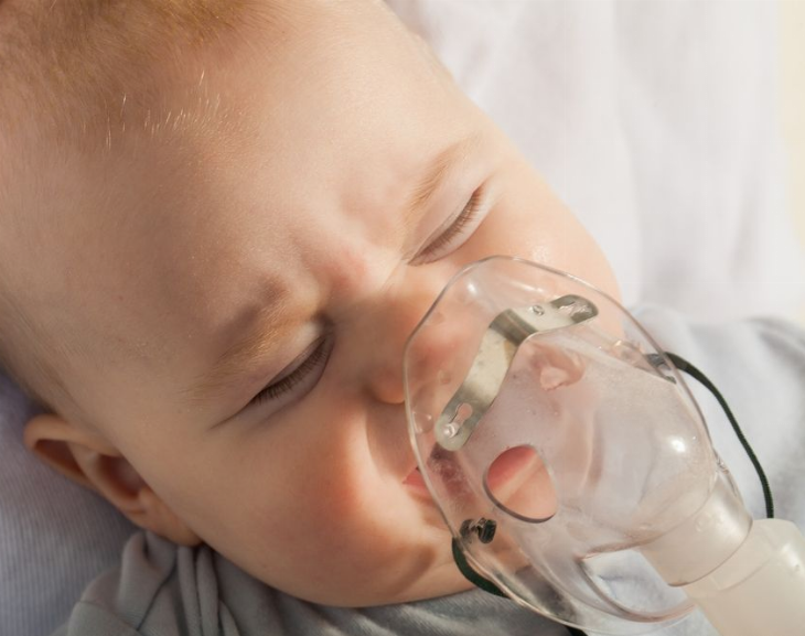 Después de 6 décadas de investigación: crearon una vacuna contra la bronquiolitis