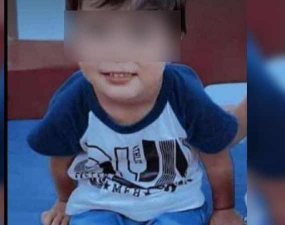 Un nene de 3 años fue atacado por un perro y está internado