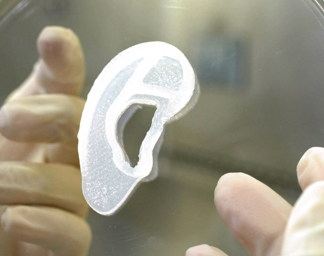 Trasplantan por primera vez una oreja impresa en 3D con células humanas