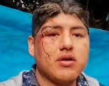 Tras una fiesta, se despertó en un ataud: se aprovecharon de que estaba borracho