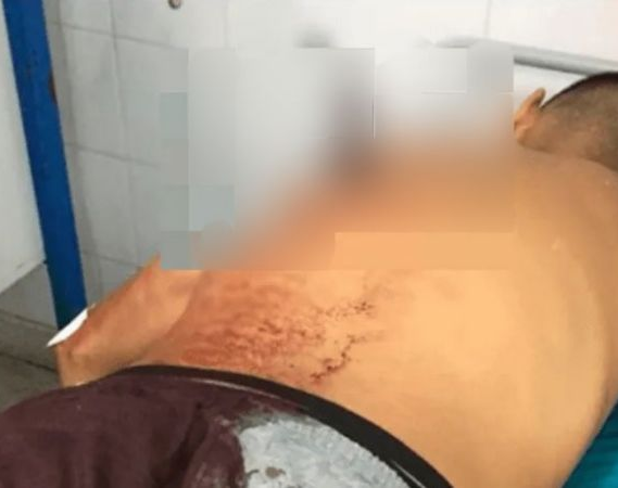 Dos jóvenes llegaron con heridas y llenos de sangre al hospital 