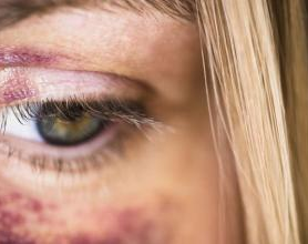 Sistema acusatorio: Golpeaba a su pareja para que no estudiara