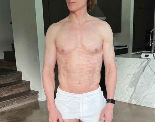 El multimillonario que quiere vivir para siempre: toma más de 100 pastillas al día