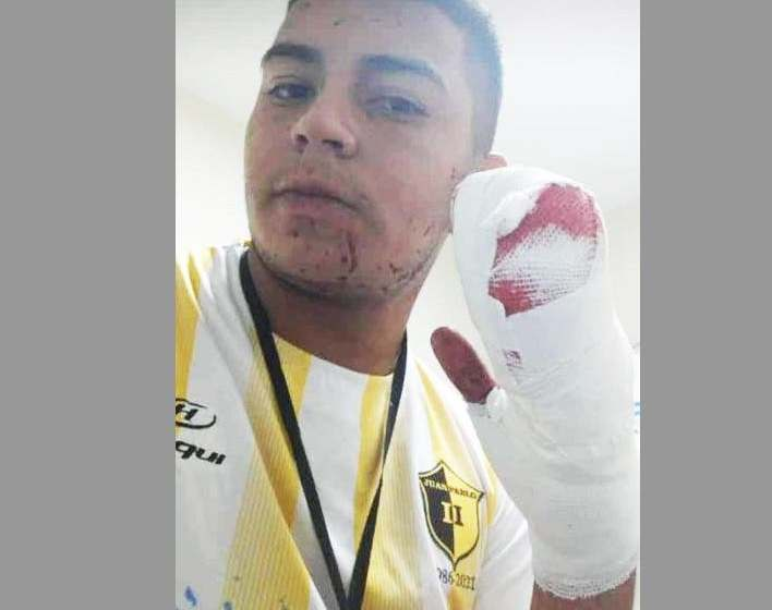 Le cortaron cuatro dedos con un machete a un joven delivery para robarle la moto y el dueño del local tomó una tajante decisión