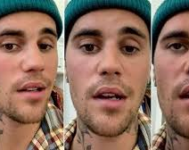 Justin Bieber canceló varios shows de su gira por sufrir una parálisis facial