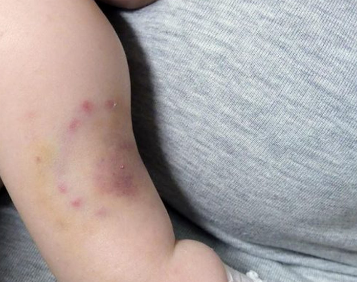 Un adolescente detenido por atacar con mordiscones a su bebé