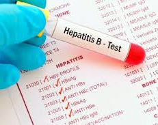 Un estudio vincula la hepatitis grave detectada en niños con el coronavirus