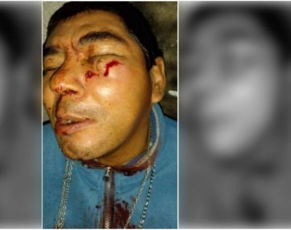 Sin Límites: golpeó a un hombre con discapacidad  y lo atraparon