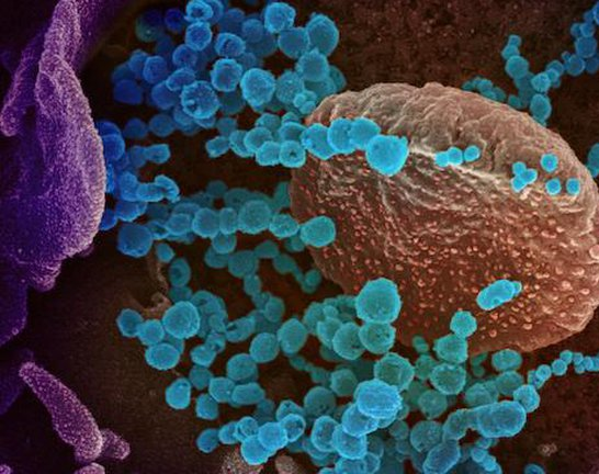 Detectan el primer caso de síndrome anal inquieto como consecuencia del COVID-19