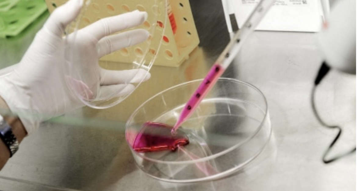 Avanza el desarrollo de un test para detectar cáncer de mama y de próstata en forma precoz