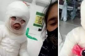 Una nena de 3 años fue víctima de un lamentable accidente en un restaurante