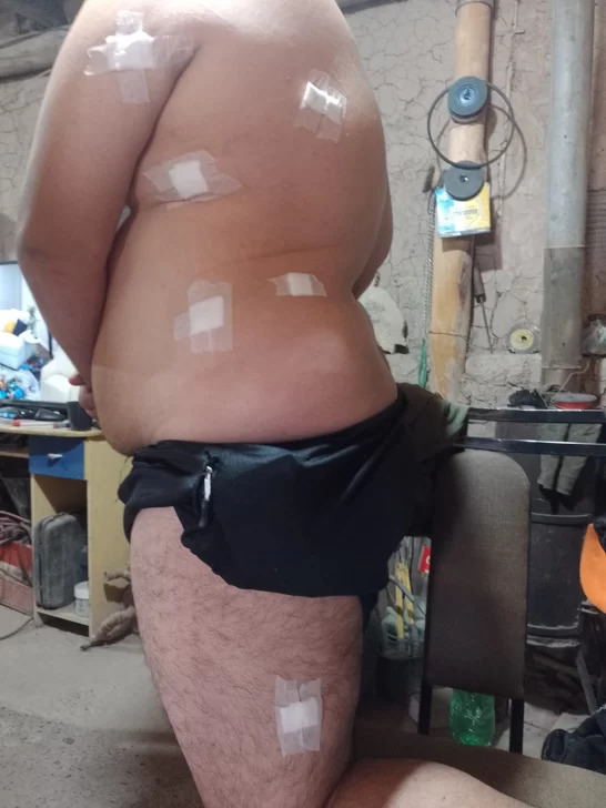 Volvía en bici de su trabajo y lo apuñalaron siete veces en una zona oscura