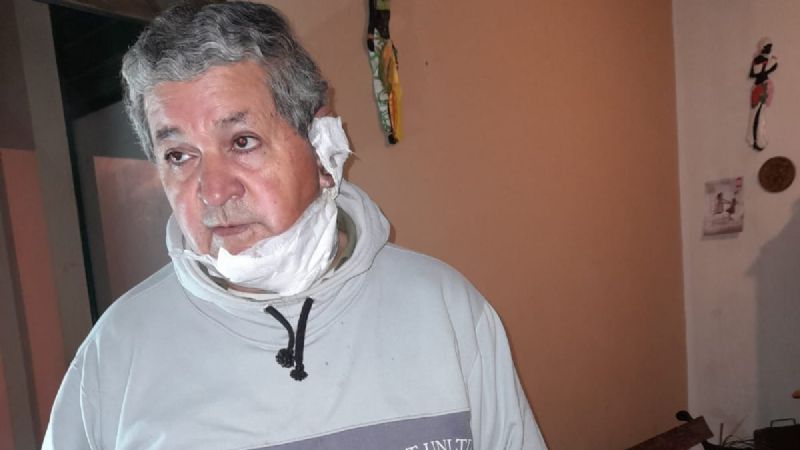 Su ex intentó quemarlo, ella quedó libre y ahora él la acusó de psicópata