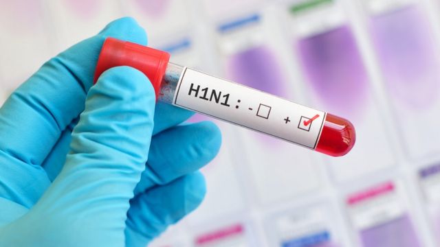 Aumentaron los casos de Gripe A en la provincia