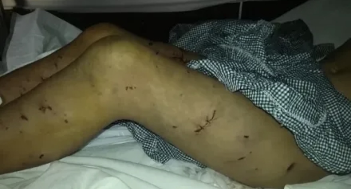 Un nene de 9 años fue atacado por una jaurÃa en Mar del Plata