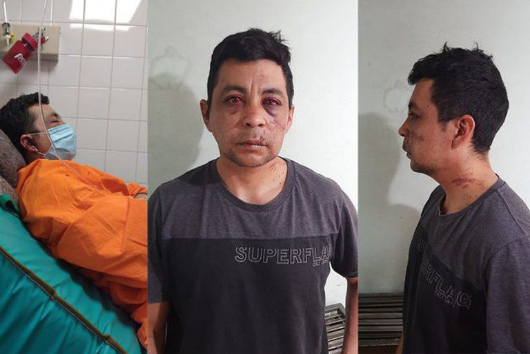 Un enfermero linchado por sus vecinos en 2020, murió de un paro cardíaco