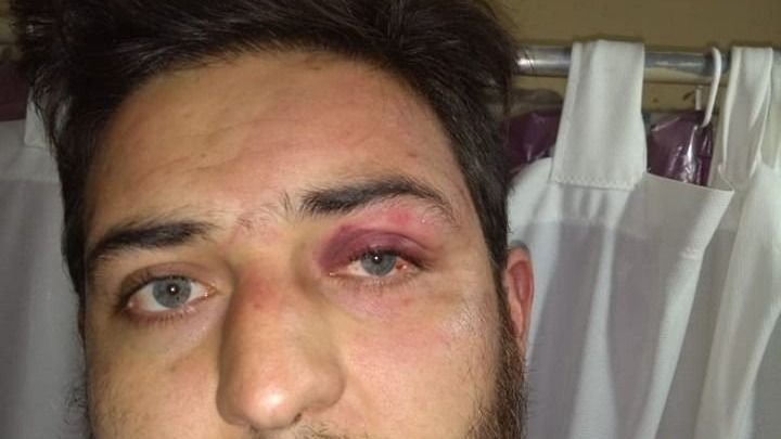 Golpiza en Pocito: echaron a los seis policías