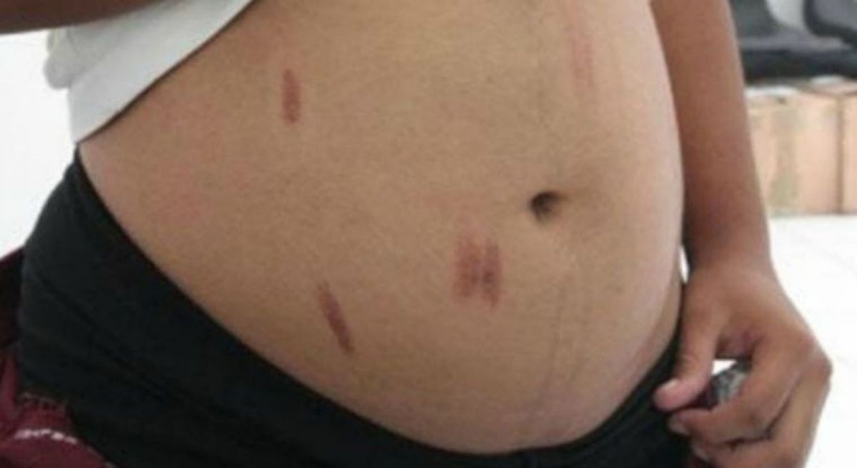 Dos hermanas embarazadas resultaron heridas luego de agredirse con cuchillos