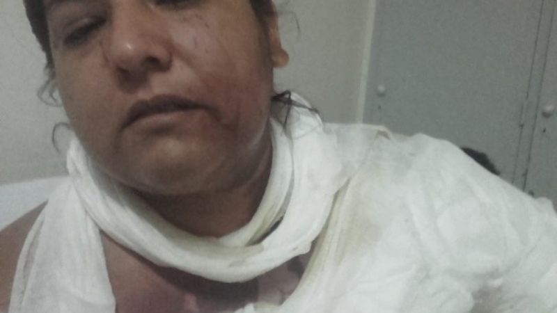 De locos: discutió con su nuera y le tiró agua hirviendo