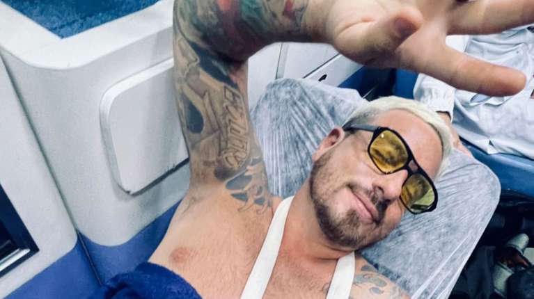 Fede Bal se accidentó en Brasil y deberá ser operado
