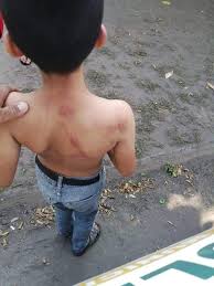 Conmoción en Jáchal: un niño denunció a su tío por golpearlo