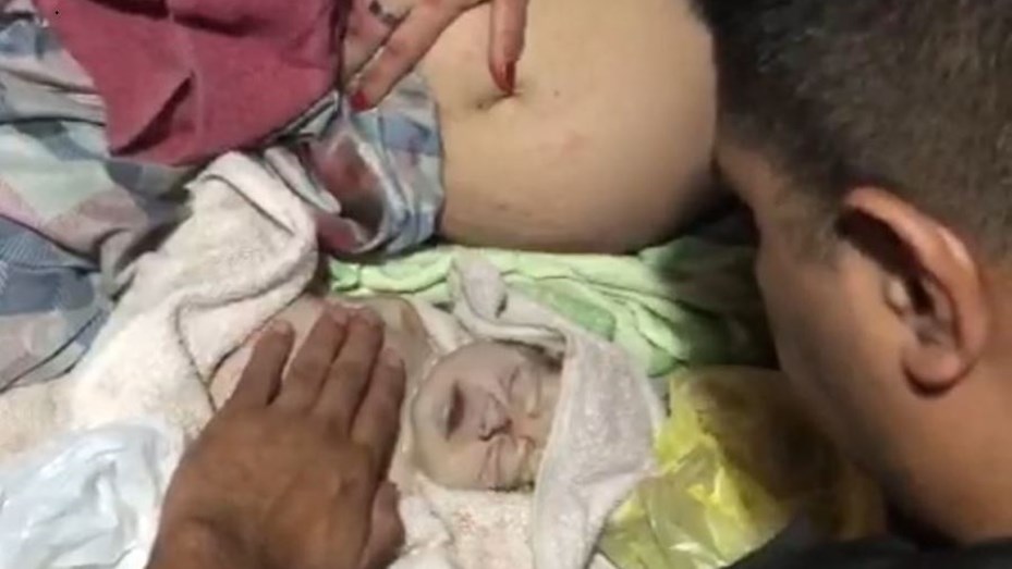 Un bebé que nació sin signos vitales fue reanimado por un polÃcia y se salvó
