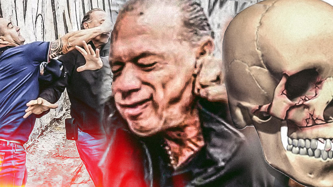 Berni tiene fractura de maxilar pero declaró que es "parte de su trabajo"