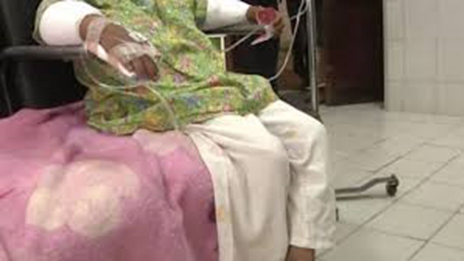 Extrema disciplina boliviana: le quemó las manos a su hija por haber robado dulces