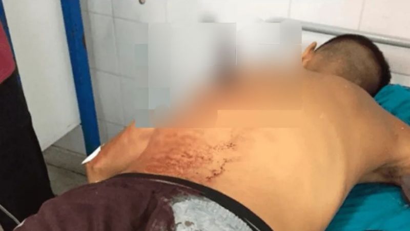 Dos jóvenes llegaron con heridas y llenos de sangre al hospital 