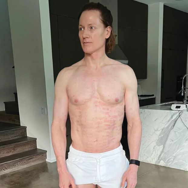 El multimillonario que quiere vivir para siempre: toma más de 100 pastillas al día