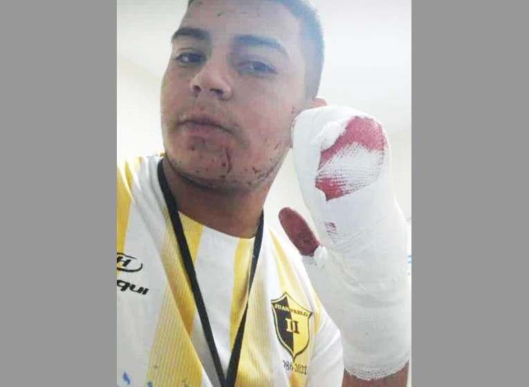 Le cortaron cuatro dedos con un machete a un joven delivery para robarle la moto y el dueño del local tomó una tajante decisión