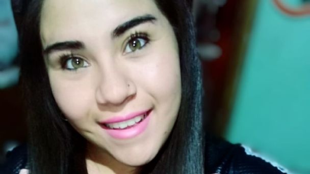 Una joven fue atacada por una jauría y habló por teléfono mientras los perros la mordían