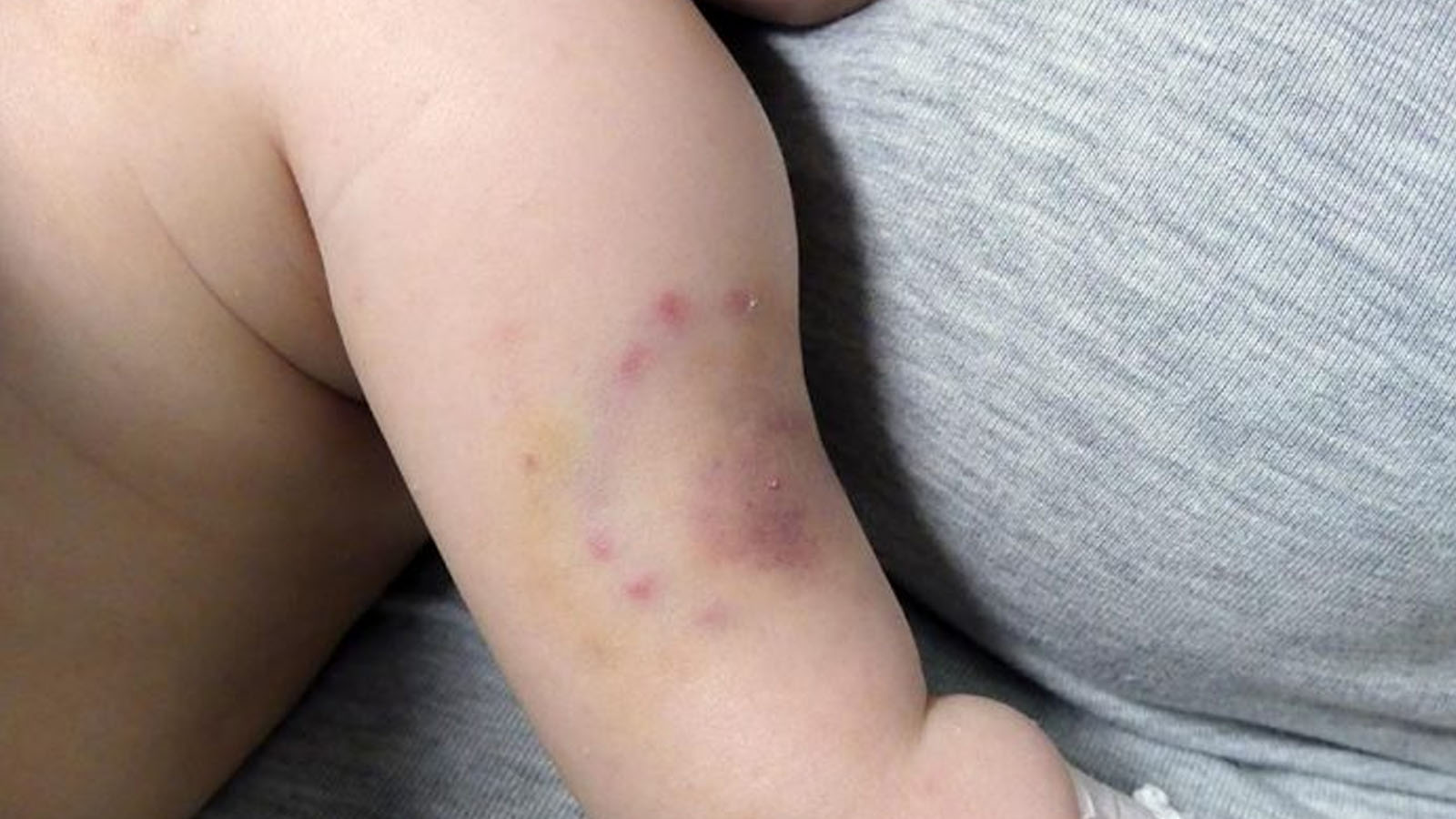 Un adolescente detenido por atacar con mordiscones a su bebé