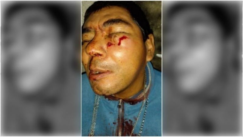 Sin Límites: golpeó a un hombre con discapacidad  y lo atraparon