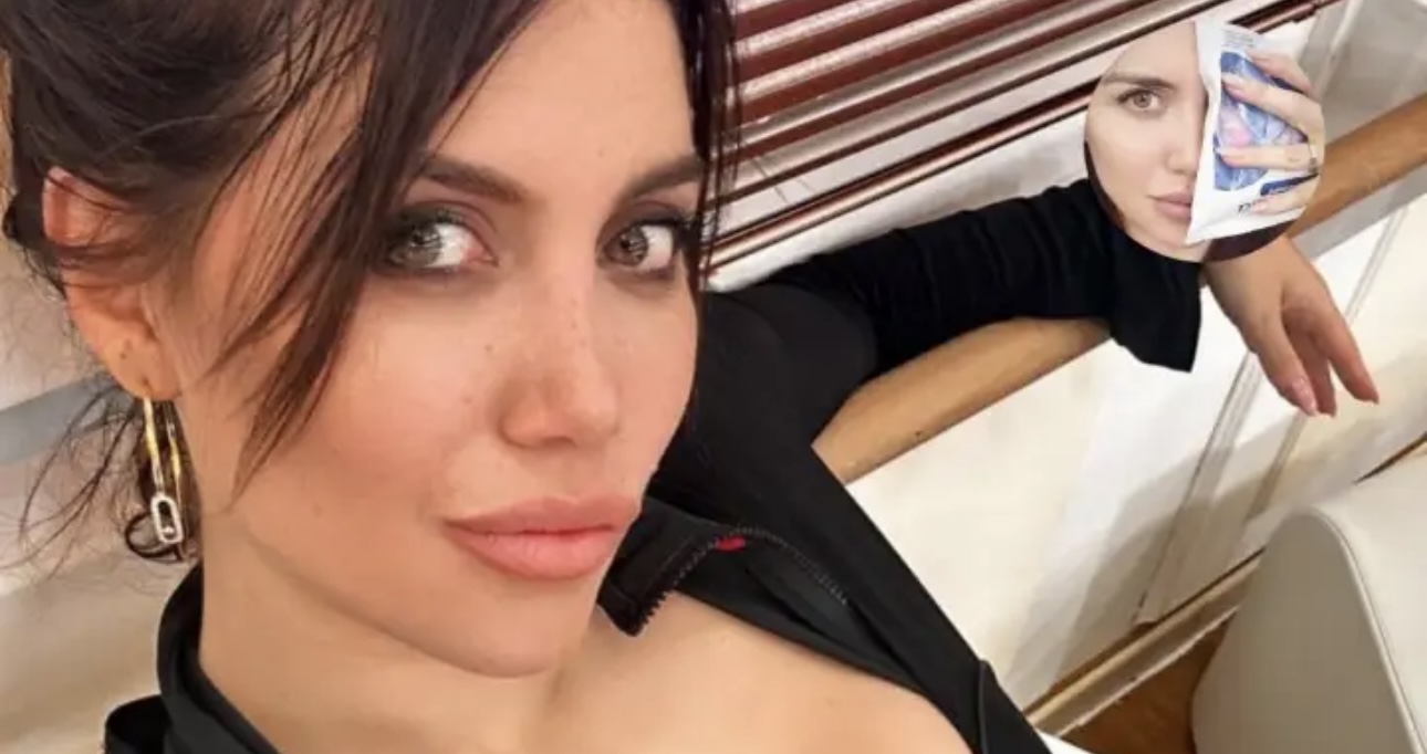 Wanda Nara sufrió un grave accidente en los ensayos del Bailando de Italia